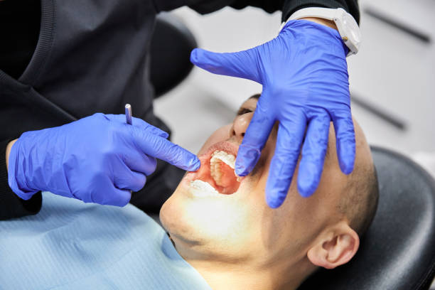 Best Emergency Dental Care for Broken or Chipped Teeth in Apison, TN